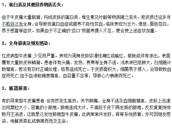 莫要忽視牛皮癬疾病，以下幾種危害你了解嗎？