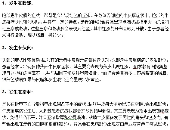 牛皮癬疾病常見的發(fā)病部位有哪些？