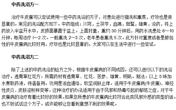 教你用中藥洗浴方法巧治牛皮癬