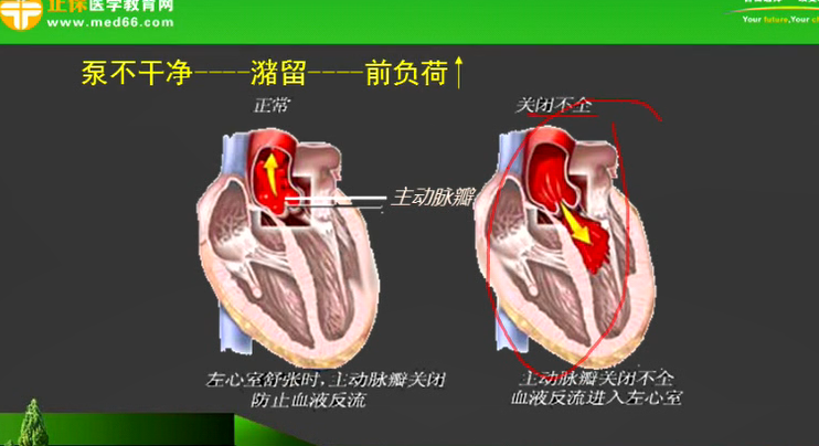 心臟的前負荷和后負荷