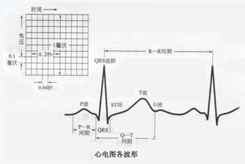 心電圖各波簡介