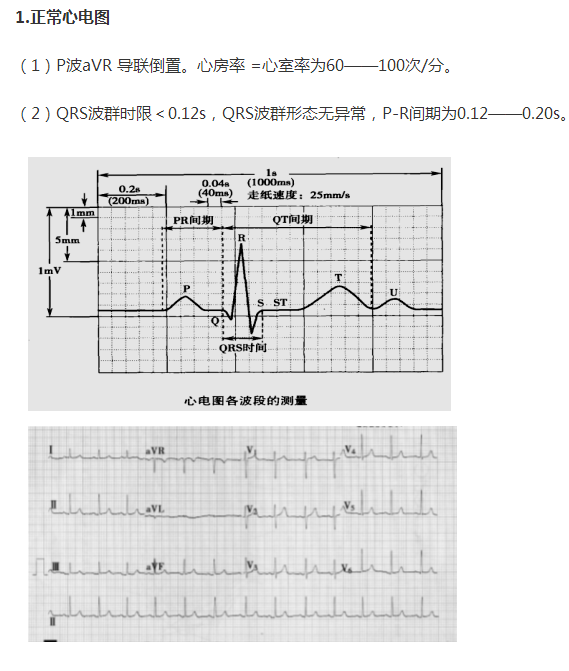 正常心電圖